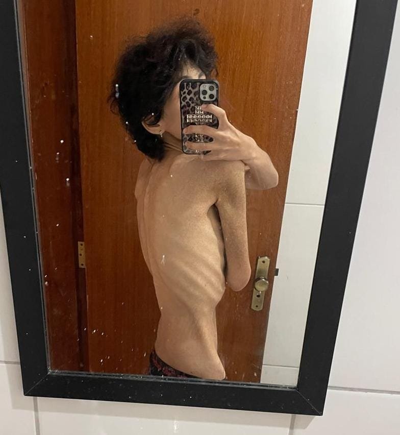 puke0cal's tweet photo. I took this first photo 5th october last year so 11 months difference https://t.co/Sx87K5o7Ge