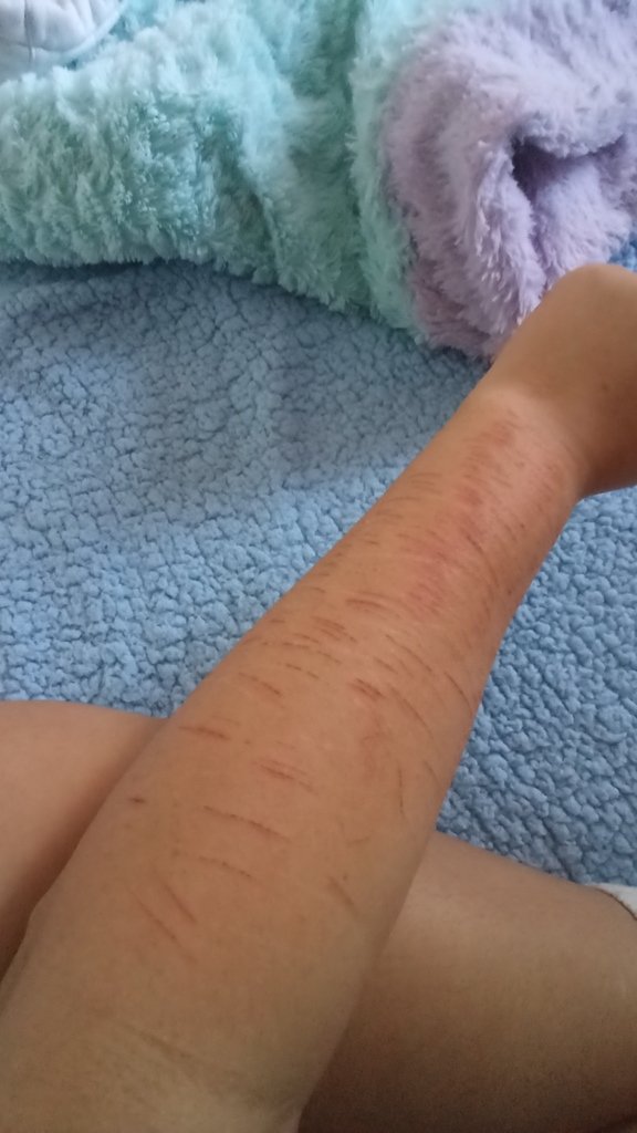 Elizo416280's tweet photo. guys my arms hurt sm this is fake ai ai totally not reql (also reuploada of last nights pics when i first did it totally fake ai ai ai) https://t.co/s3bS1SKuRh
