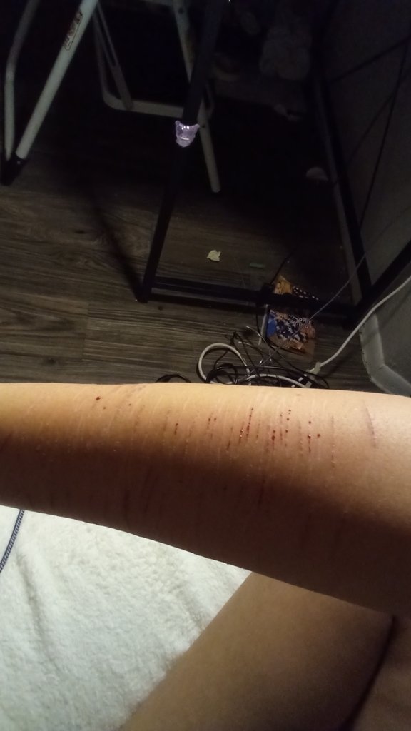 Elizo416280's tweet photo. guys my arms hurt sm this is fake ai ai totally not reql (also reuploada of last nights pics when i first did it totally fake ai ai ai) https://t.co/s3bS1SKuRh