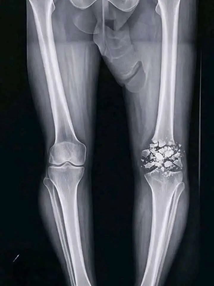 kaelmorenotele's tweet photo. Dammm bro :(( https://t.co/nx95nDiFyw