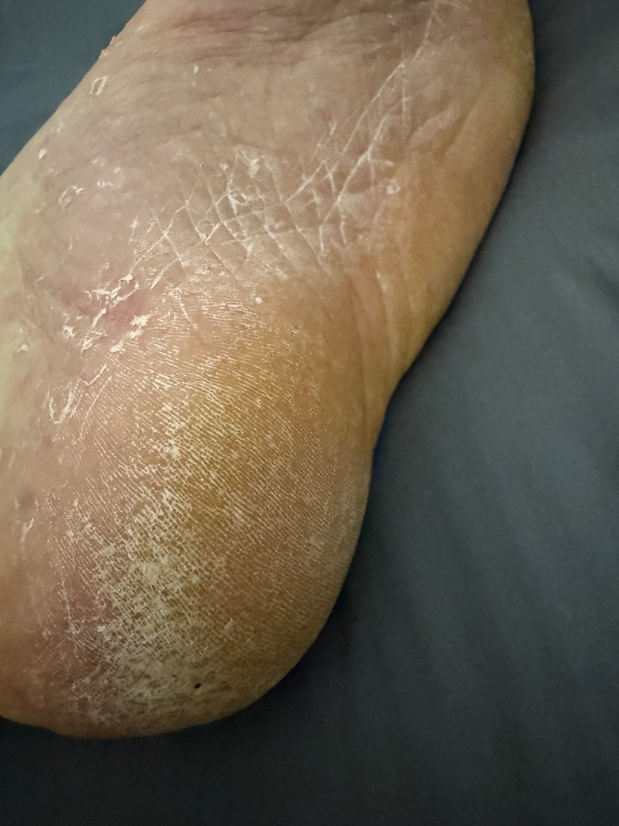 Real_NoFilter's tweet photo. Morning sniffers… Sunday Fun Day https://t.co/eQwV3dx6GS