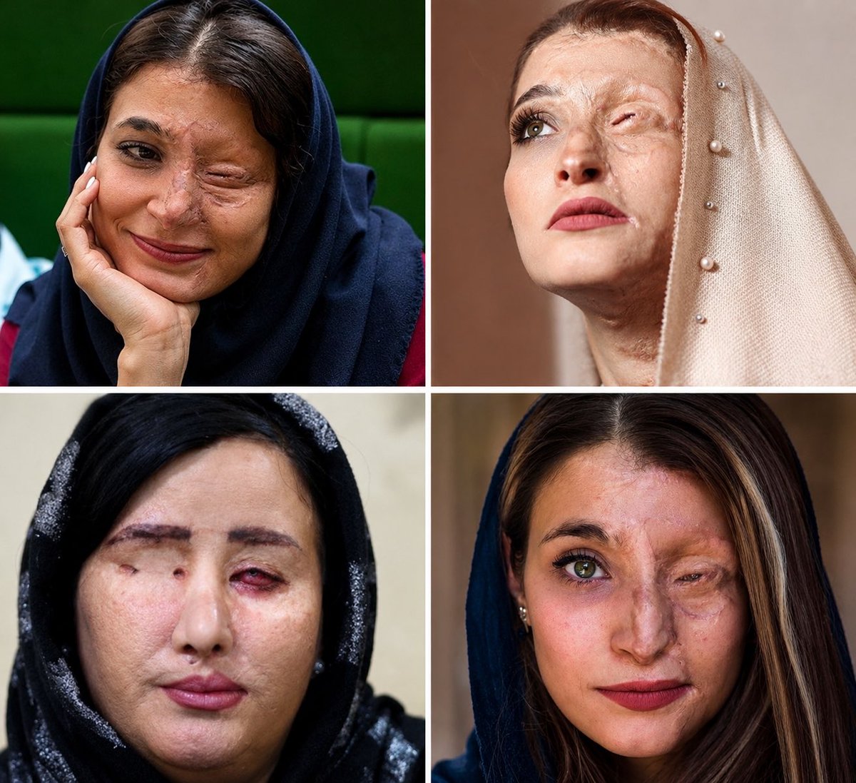 alainpaulweber's tweet photo. Vous mettez le voile par solidarité, jeune écervelée ?

Marzieh Ebrahimi, Soheila Jorkesh, Neda M. et Maryam. ont voulu l’enlever…

Inutile de déranger @grok pour cela, les images abondent. https://t.co/w2KqswGYVw