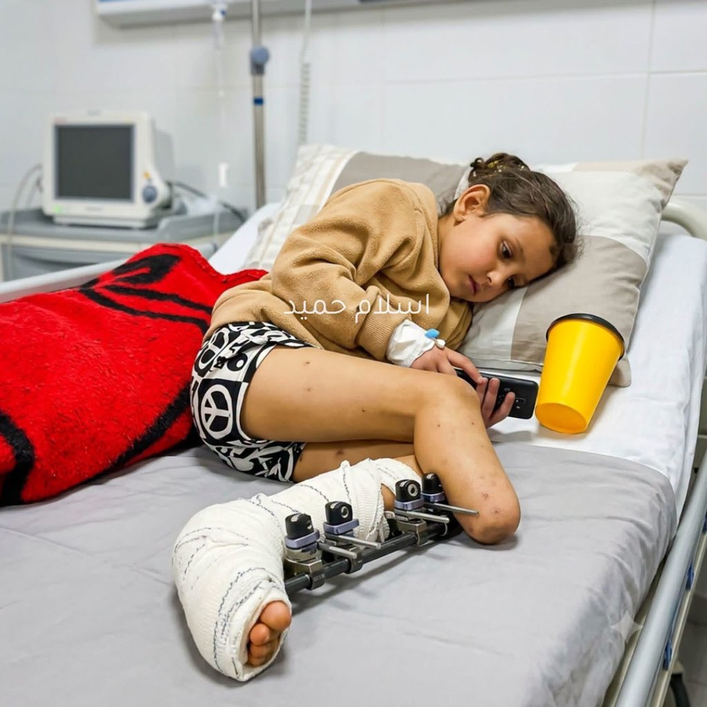 AhmedAAshour8's tweet photo. One foot was amputated, while the other has a metal plate, and a small body carries a pain far greater than its age
Our children are Israel’s targets https://t.co/ZOw6W9inTc