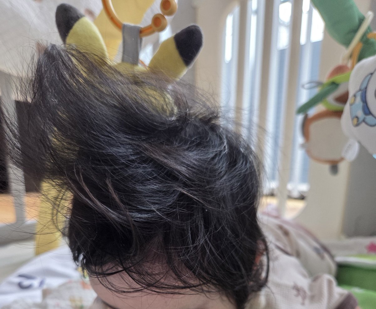 inoemon_'s tweet photo. 娘ちゃん（5ヶ月）のこれはいつ落ち着く？？？重力逆らいすぎちゃう？ https://t.co/pC34A2ihAG