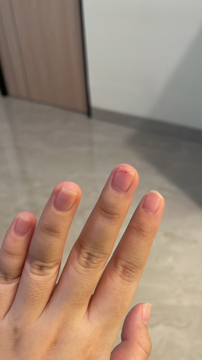 xwinternz's tweet photo. ada aja cobaan hari ini 😔 gaberani cabut lagi hiks https://t.co/7CmdQxUGb3