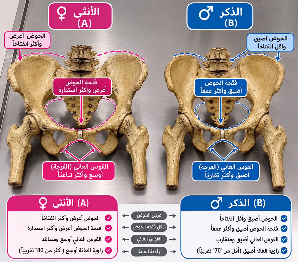 sga_1994_'s tweet photo. @yorgunprensesq * A = الأنثى ♀️ — الحوض أعرض، وفتحة أسفل الحوض (القوس العاني) أكثر اتساعًا.

* B = الذكر ♂️ — الحوض أضيق وأكثر عمقًا، والقوس العاني أضيق https://t.co/k14gJZ51df