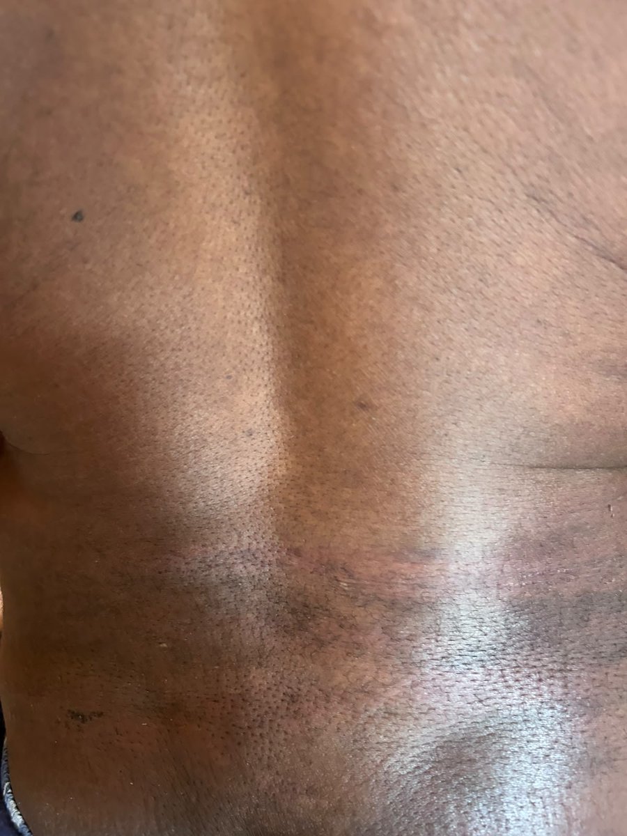 LsNewsday's tweet photo. 𝐁𝐑𝐄𝐀𝐊𝐈𝐍𝐆 | Newsday Editor and human rights activist Kananelo Boloetse was abducted, tortured and later abandoned at Thaba-Bosiu yesterday. https://t.co/LYT7DGPuPj