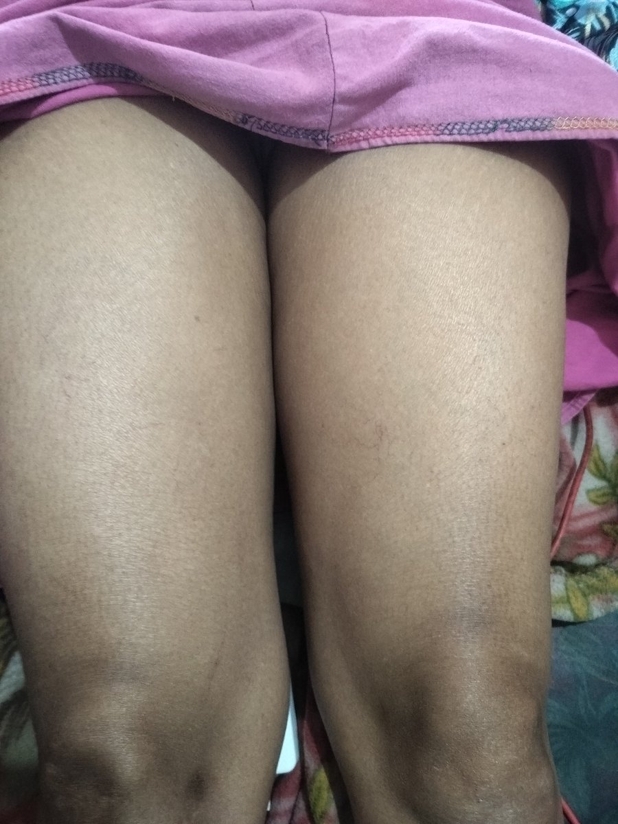 queenwxpv's tweet photo. Sunday 😘 
Night service available 
Video call conformation free 🔥
100% genine service available 
Telegram link 👇👇👇
https://t.co/NlWyOZFsi8
https://t.co/NlWyOZFsi8 https://t.co/KPJ1v1WXEv
