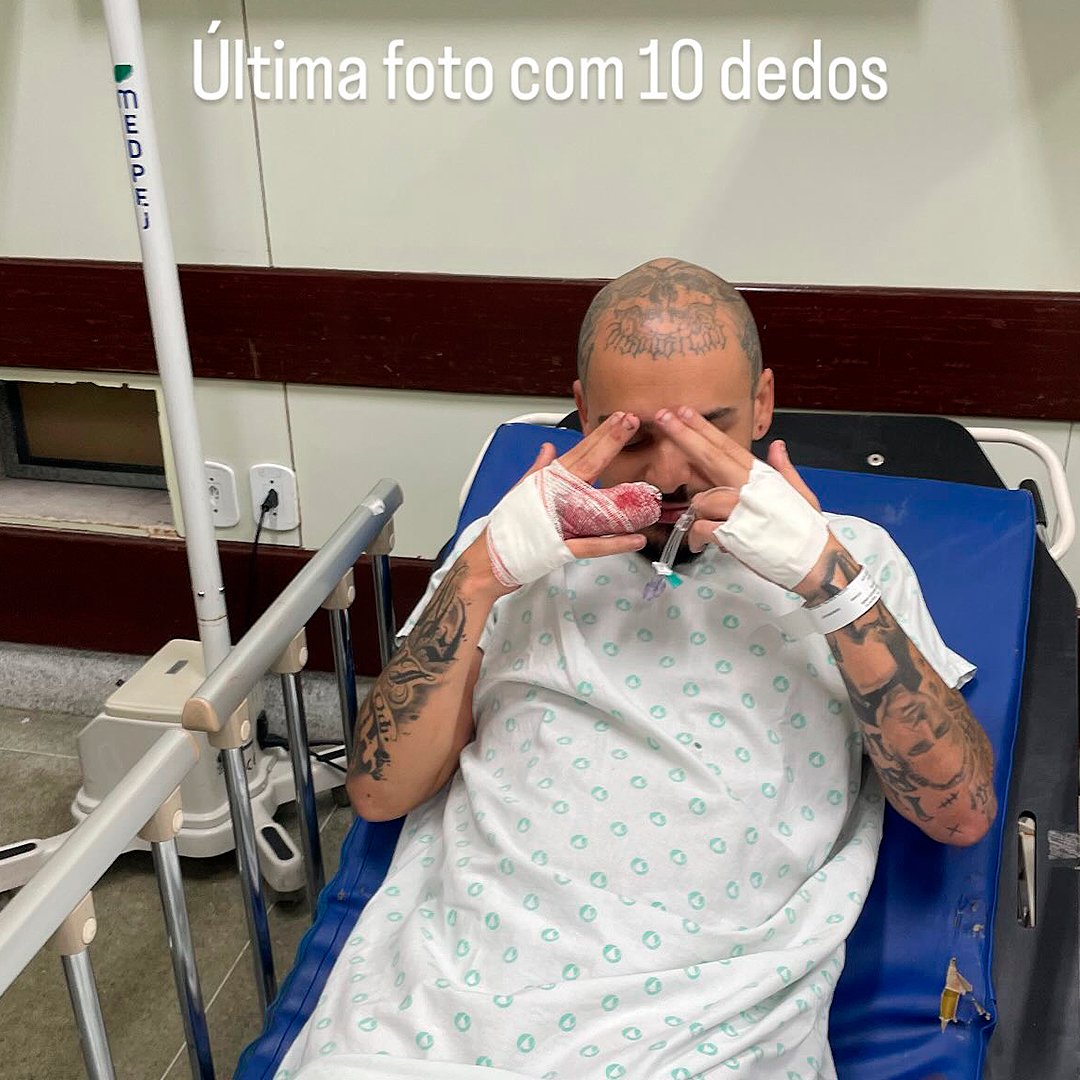 Portal_Insider's tweet photo. 🚨 Lodk postou stories antes e depois da cirurgia e infelizmente precisou amputar o dedo

“Última foto com 10 dedos” https://t.co/I8BABWEs0P