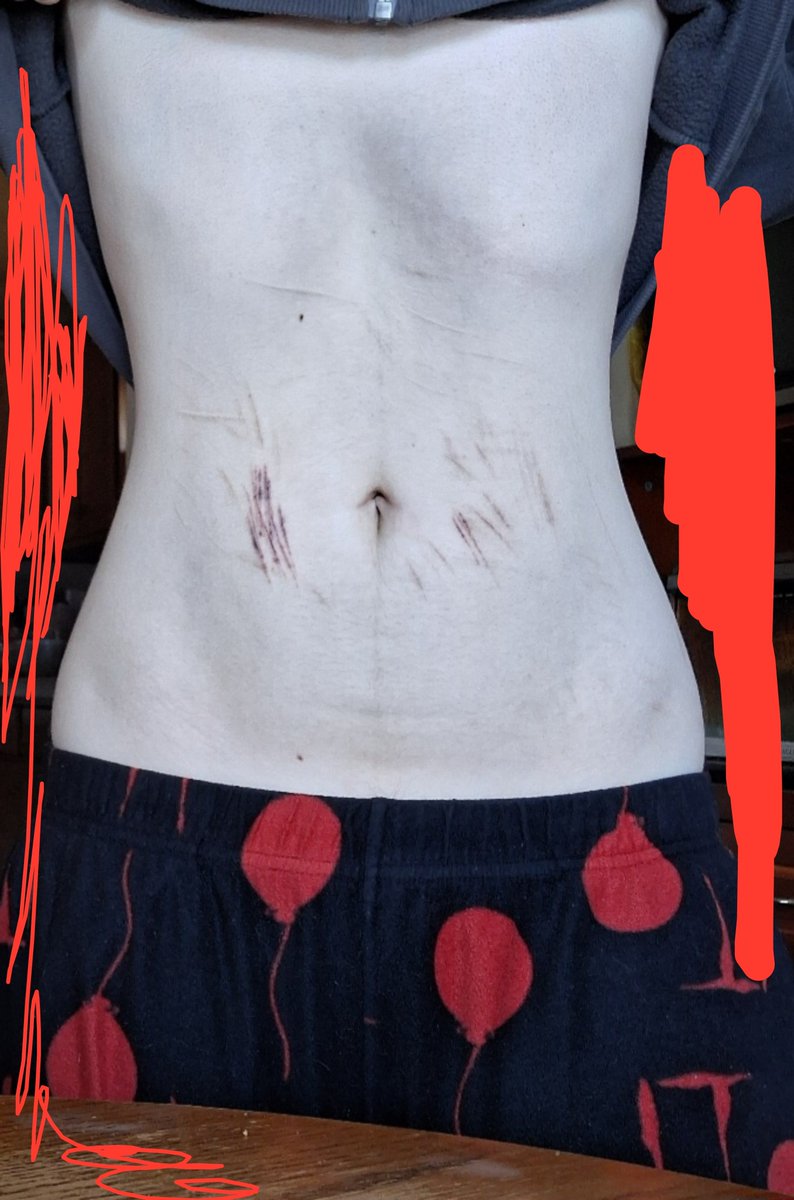 roadkillddog's tweet photo. bodycheck after eating and drinking
before my walk

im getting 30k steps today https://t.co/sxjXXehxvA