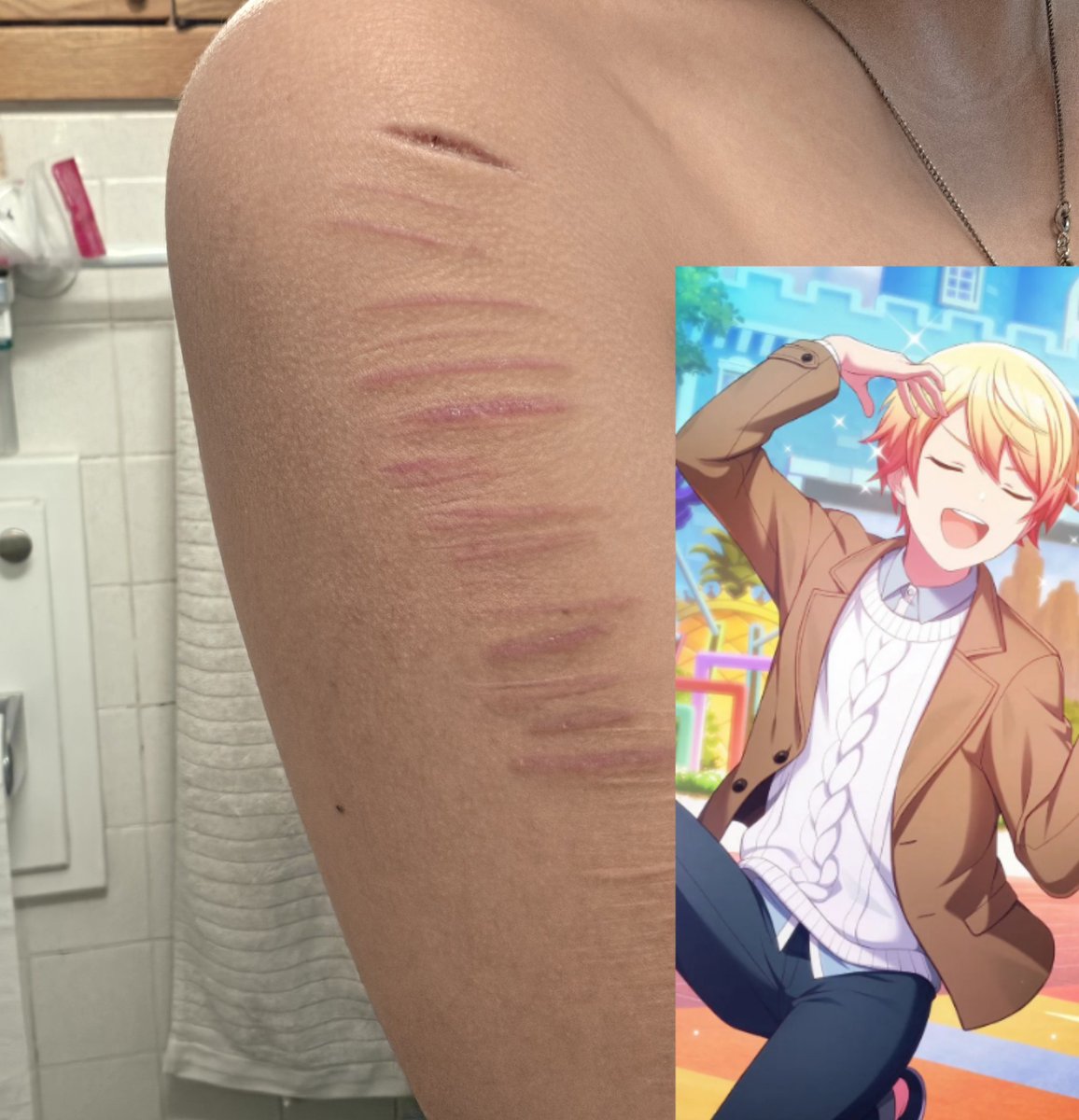 dolledupkamurai's tweet photo. FAKE SCARS theyrehealing well i think SUPER FAKE AI SFX MAKEUP https://t.co/bRYSrnqRTj