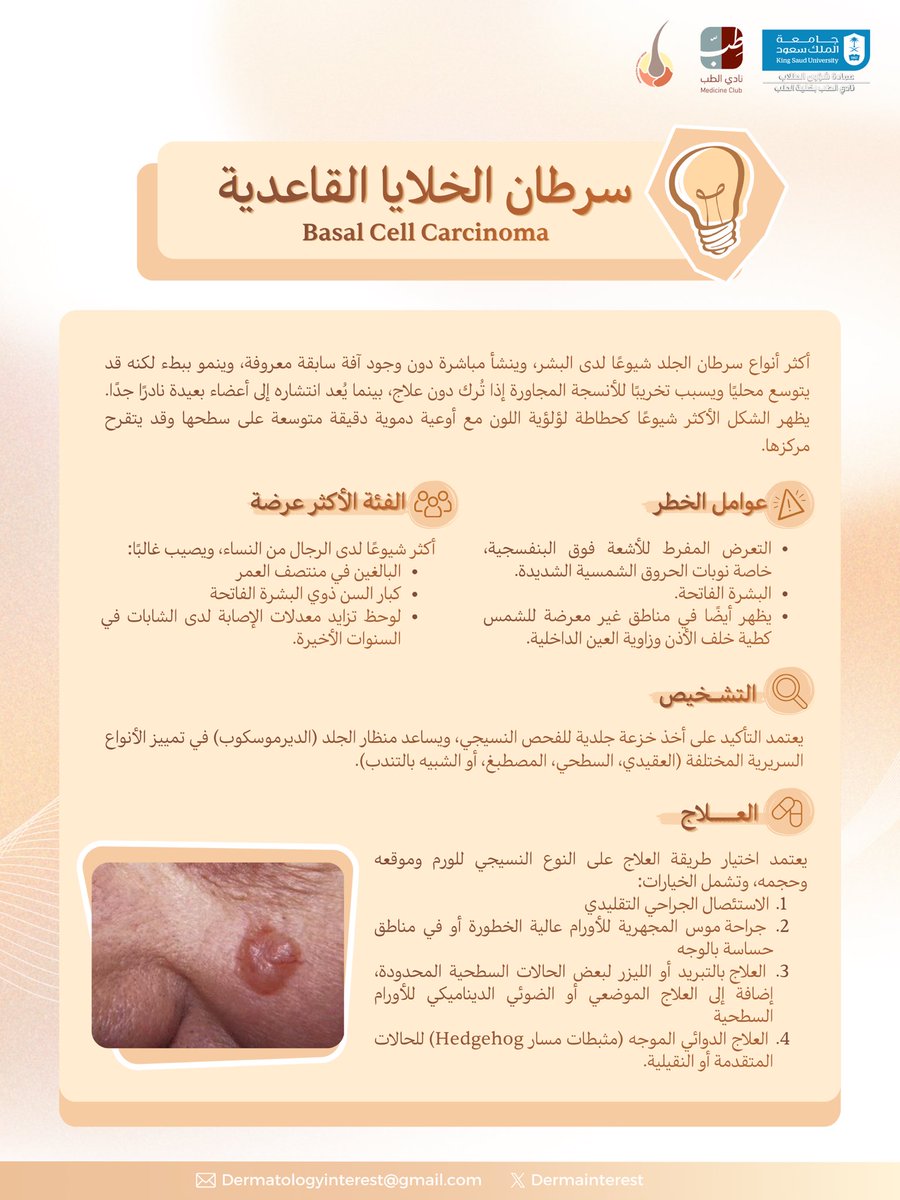 Dermainterest's tweet photo. قد تبدأ بتغيّر بسيط في الجلد… لكنها قد تكون علامة تستحق الانتباه 🔎

تعرّفوا معنا على سرطان الخلايا القاعدية، أكثر أنواع سرطان الجلد شيوعًا، وأبرز ما يجب معرفته عنه ☀️

#DermFact
#سرطان_الجلد
#سرطان_الخلايا_القاعدية
#طب_الجلدية https://t.co/FZvTtV2E1s