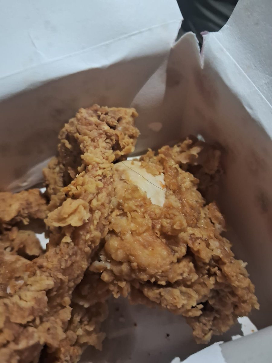 Attenderff's tweet photo. @Swiggy  @SwiggyCares  got hair in my kfc in my yesterday's order and I haven't recieved any resolution and no one from ur team contacted me so far. I have mailed my concern and still no reply. This negligence is not acceptable at all. @jagograhakjago please look into the matter https://t.co/ANAP16A5J3
