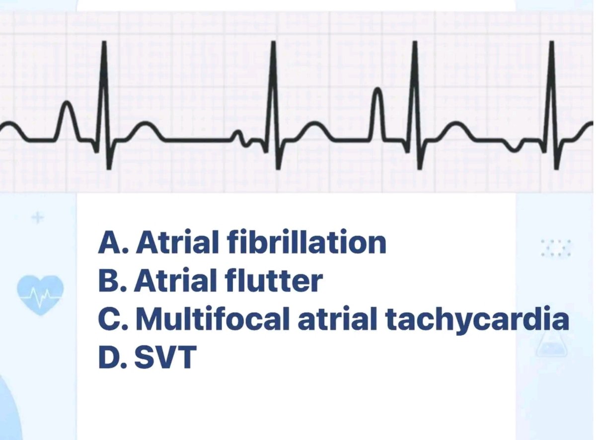 Doctors_GUILD's tweet photo. A 70-year-old man with severe COPD develops palpitations.

Diagnosis? https://t.co/PoT5fbTm5N