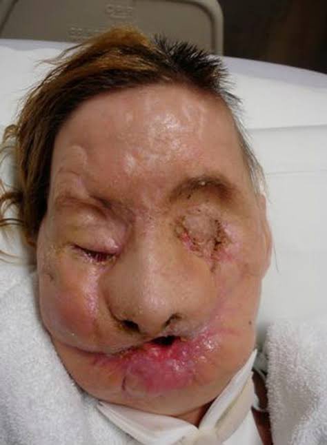 nwordbrof1's tweet photo. @JeffeTatum @coeycookes @Unkn0wnId_ @Dinoo_Dinnoo @Tomozaurus This is human after chimp attacked in 2009 https://t.co/k1sKnBmxiU