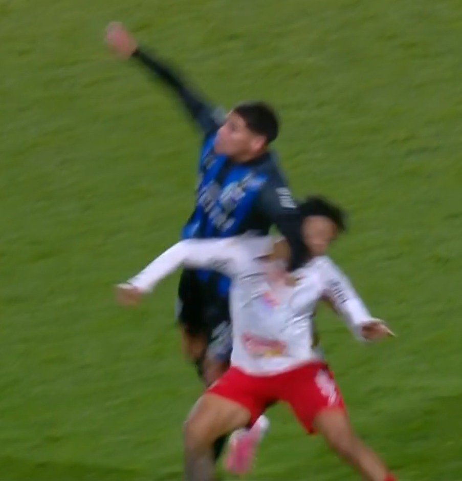 ArbitrajeU's tweet photo. 🚨 NEFASTO ARBITRAJE DE FERES!!

❌ Penal inexistente a Martínez por supuesta sujeción. Lo salvó que hubo offside previo.

❌ Codazo a Saravia sin falta: jugó 10’ con la cara ensangrentada.

❌ Penal mal sancionado para Boston River. Brazo en posición natural y no hace ningún movimiento adicional.

❌ Revisión caótica: sale corriendo sin hcer señal del monitor y expulsa a un jugador. Otro jugador se quedó mirando y hablando atrás de él 😳

Ya saldrá De León a justificarlo o darle de VAR par cuidarlo… 😏