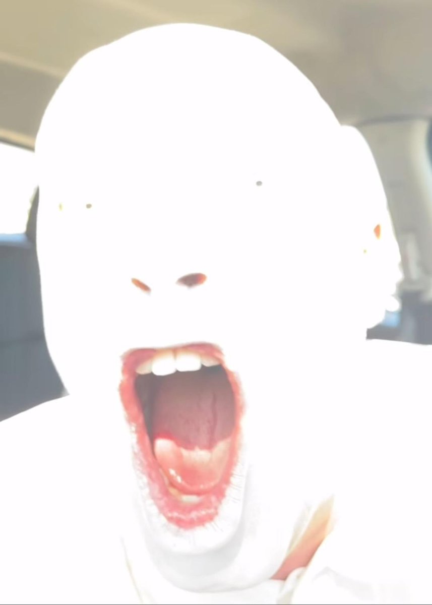 bossdrowsy's tweet photo. @spasssverderber hes so fucking ugly i HATE him https://t.co/VdfUNd3Q7J