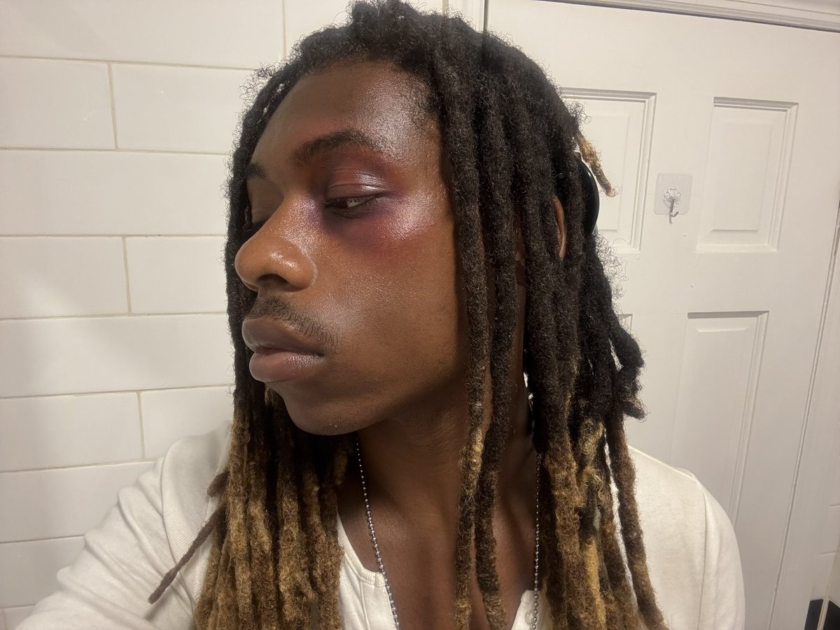marquismasse's tweet photo. 🤕 https://t.co/x4FZCSB78D