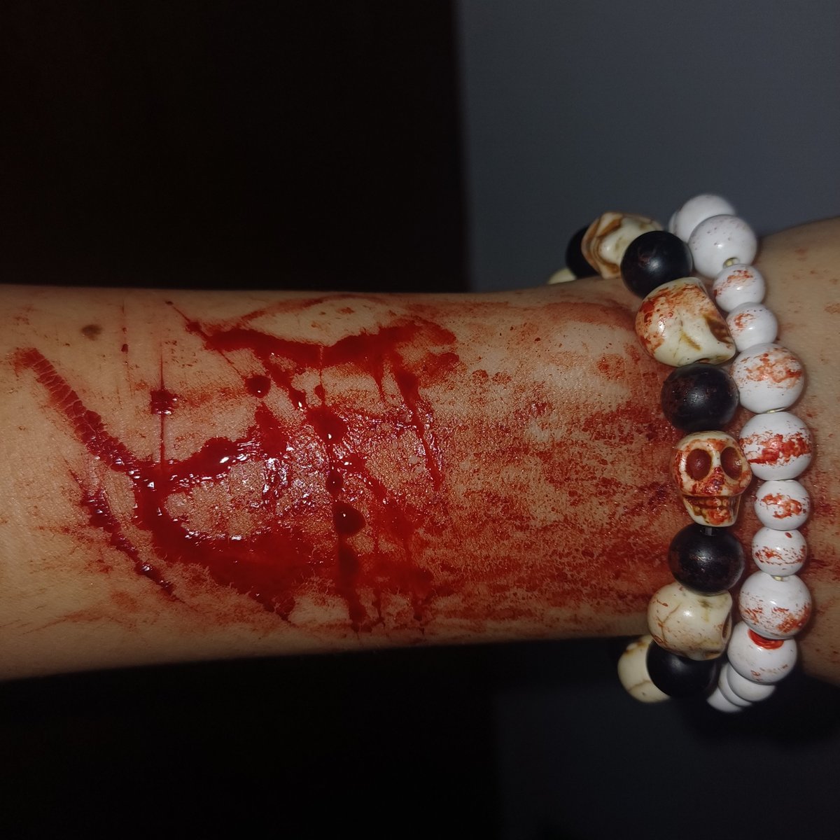 HanniaReye78134's tweet photo. #fakewounds (,,Ծ‸Ծ,, ) https://t.co/6u69MNlLH8