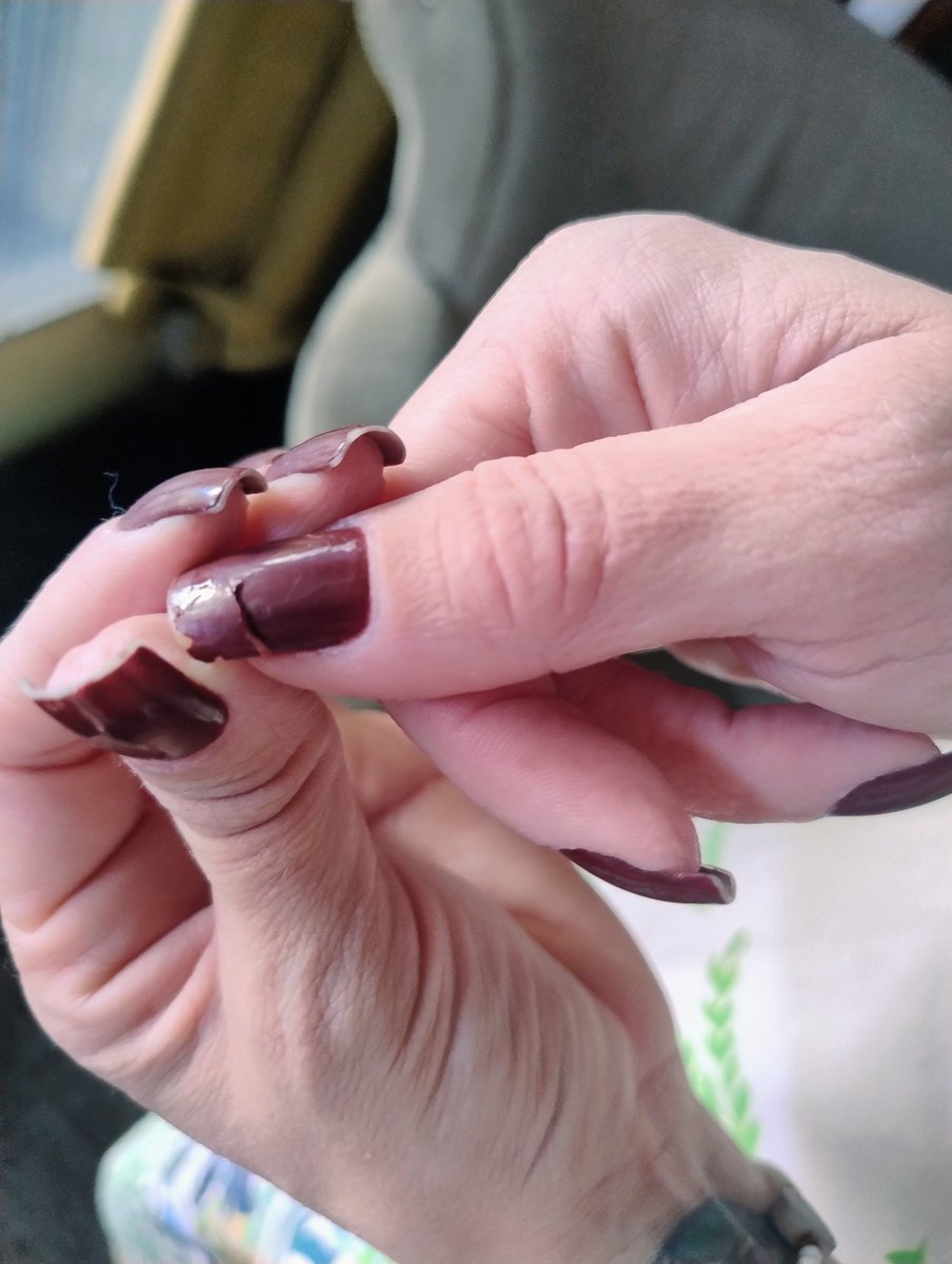 feee_silvaaa1's tweet photo. Tem gente que não acredita em mau olhado/inveja/olho gordo.
Tem uma querida que sempre que me vê, elogia minhas unhas ( por ela ser natural, por não quebrar ).
Aí ela me pergunta sempre a mesma coisa, que base que eu uso, esmalte.
Tinha + de 6 meses que não a via.
Pois bem.... https://t.co/YyDL8oCzd0