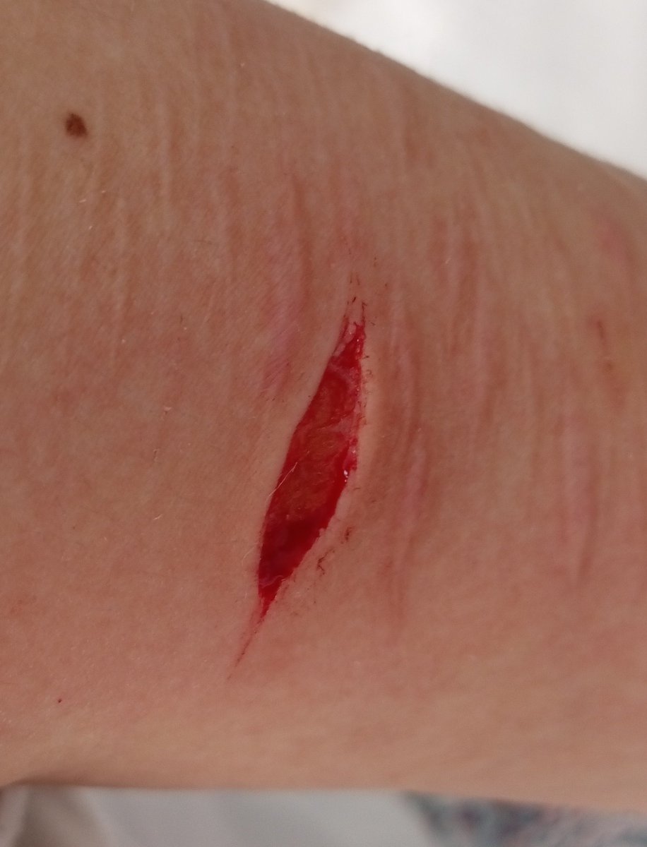 evaniscrazy's tweet photo. So tiny I love this sfx make up for Halloween I think im good at sfx make up for Halloween this is all fake and sfx make up for Halloween!
#slittwt https://t.co/ssHYyziJCe