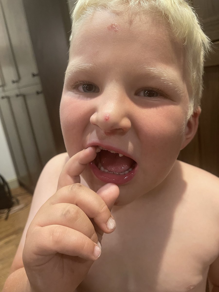 IgnoreNarrative's tweet photo. 86 lbs at 6 years old with teeth falling out daily.  ladies and gentlemen your new forward for the Brandon Wheat Kings https://t.co/hXPmOKQDVm
