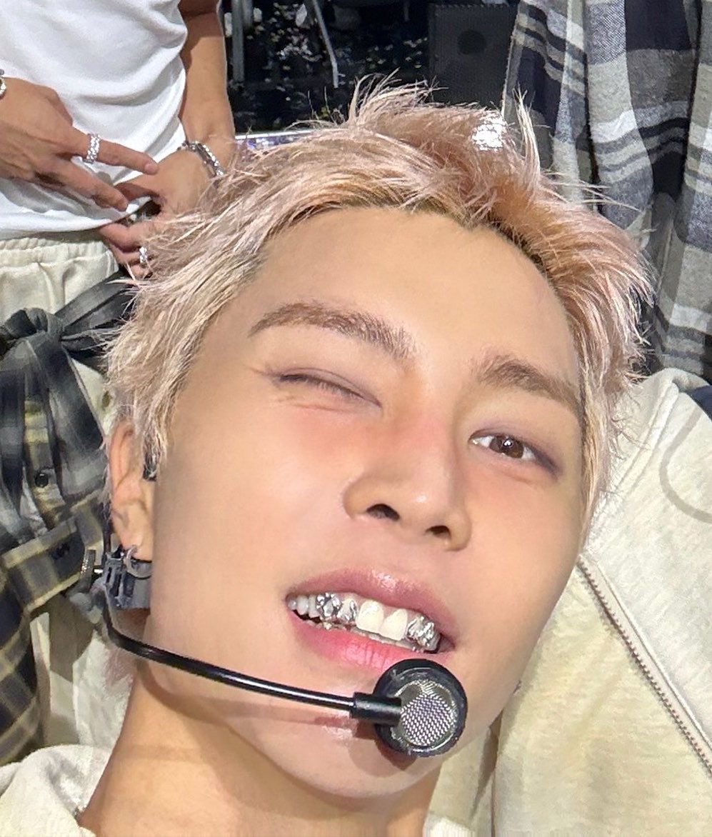 johfam's tweet photo. teef https://t.co/hmn274kI84