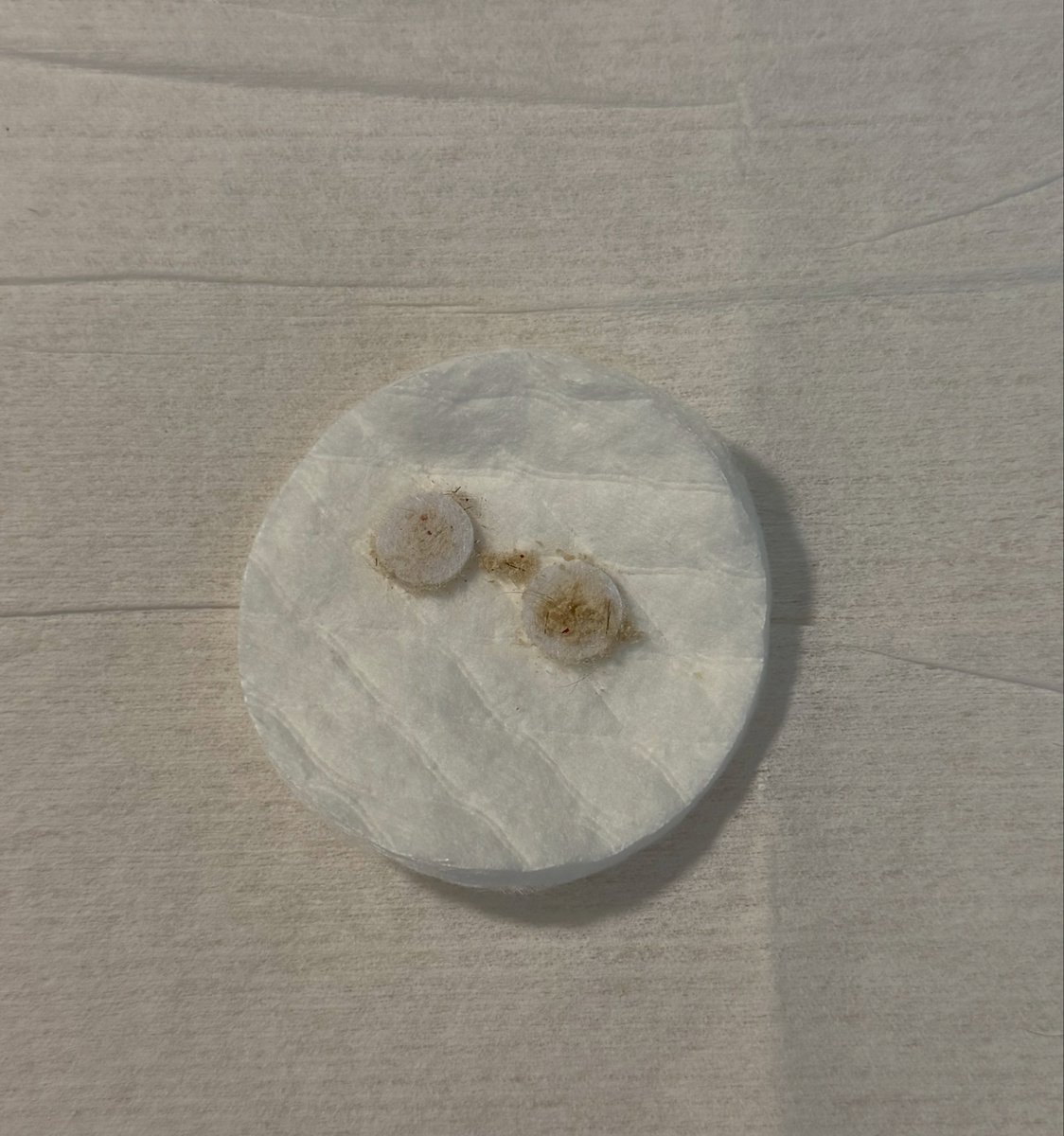 JacqueZolty's tweet photo. I’m sooo obsessed with this treatment. Microdermabrasion. After just one session: sebum, dead skin cells, and buildup that can clog pores. I recommend it about once a month for deep cleansing, smoother-looking skin, and better product absorption. https://t.co/EORun2GDjj