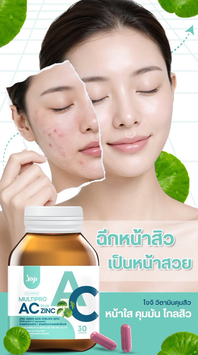jonathas_sants's tweet photo. Break free from the acne cycle with Joji Acne Control Vitamins. A 3-phase formula to soothe breakouts, fade post-acne marks, balance oil, and support clearer, healthier-looking skin from within. https://t.co/K0hXh8pf1Q