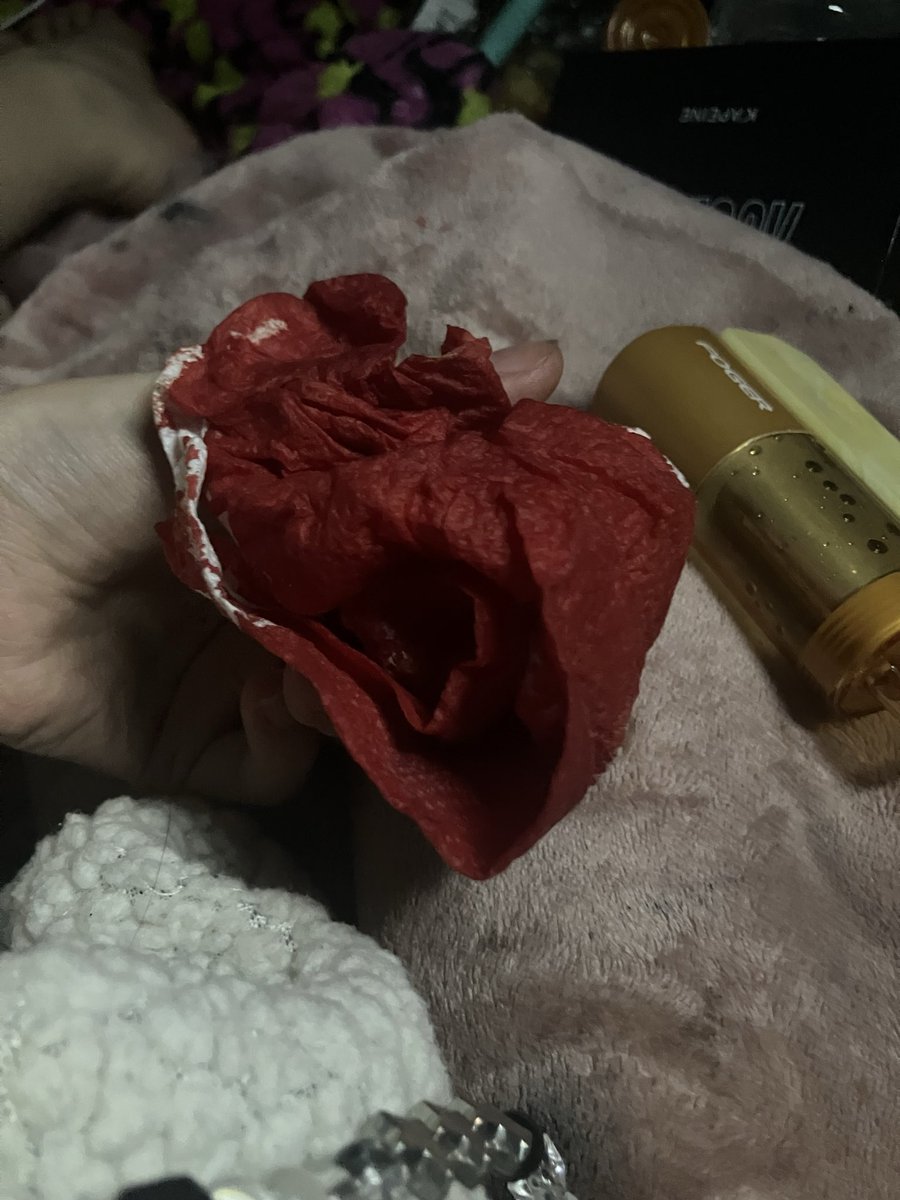 shyssuffocate's tweet photo. so all of this blood just came out of my nose at once unprovoked . should i be concerned like should i go to the hospital this is a genuine question https://t.co/noZ7jyuS3v