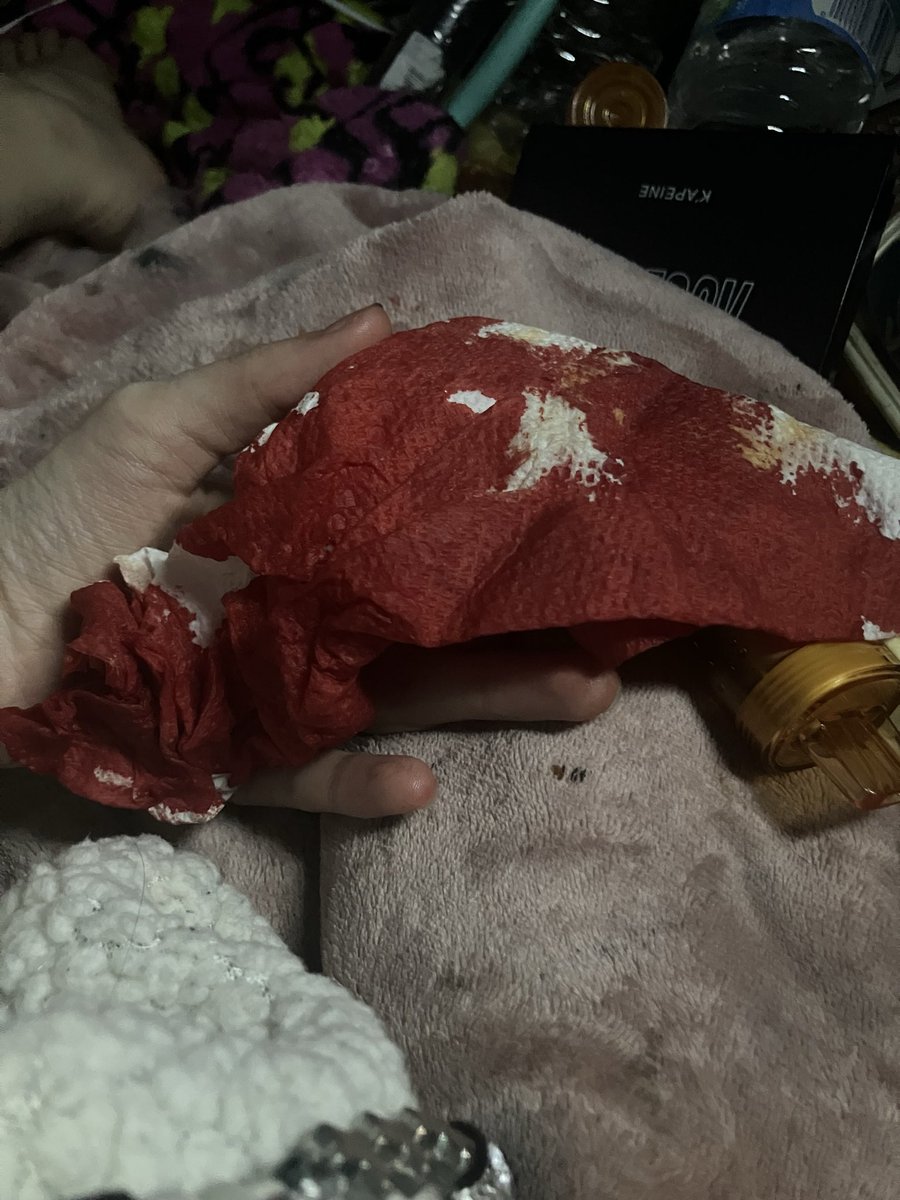shyssuffocate's tweet photo. so all of this blood just came out of my nose at once unprovoked . should i be concerned like should i go to the hospital this is a genuine question https://t.co/noZ7jyuS3v