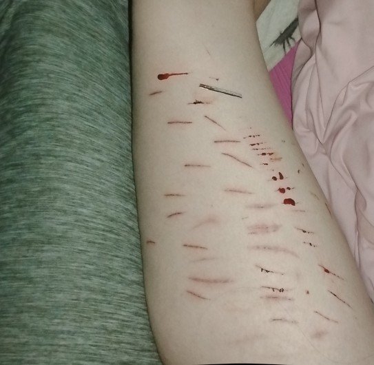 incoherent_l's tweet photo. Cat scratches.. Blade so dull ugh!!! 

AI!! FAKE AI AI AI ALL FAKE https://t.co/9pHfvlqSGs
