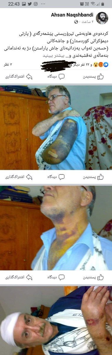 outofrange0101's tweet photo. @Kcha__Kurdistan هه‌ر ئه‌و هه‌ڕه‌شه و دو جنێوه‌یه ده‌بێته به کردار و ئاکامه‌که‌ی ده‌بێته برینی سه‌ر له‌ش و لاری ئه‌و کچه‌ی له ڤیدۆکه‌دا ��ه‌یه و ئه‌و وێنانه👇 https://t.co/CXZczTJQSP