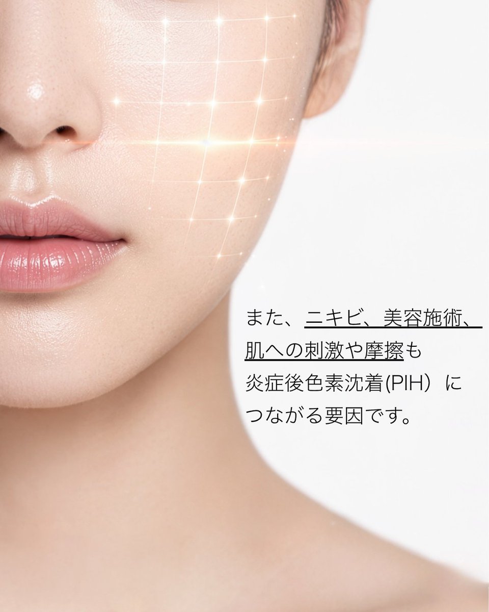 CliniqueJp's tweet photo. 【色素沈着の原因、ご存知ですか？】

9月になっても続く強い紫外線。
シミ（色素沈着）ができる原因は１つだけではありません。

☑︎紫外線
☑︎皮膚の摩擦
☑︎ニキビ跡
☑︎皮膚治療
など、多岐にわたります。

夏終わりの敏感になった肌も考慮した
アイテムで、夏の足跡を残さないスキンケアを。

https://t.co/mjDjxQkfgm

#CLINIQUE #クリニーク #evenbetter #透明感ケア #ブライトニング