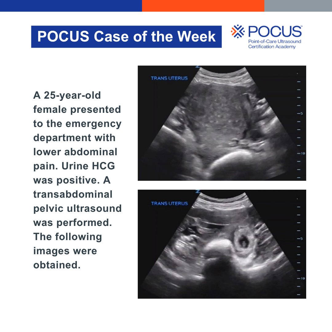 POCUSAcademy's tweet photo. π£ Case of the week!
Let us know your answer in the comments!
#POCUS #POCUSCaseStudyChallenge https://t.co/wbdhx3JBGx