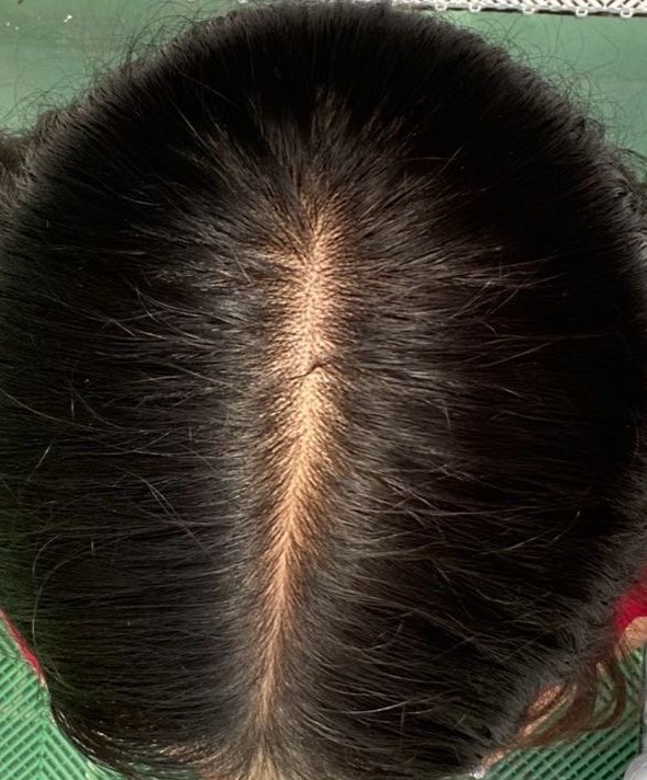 badbunny166630's tweet photo. message me if you want to share hair photos #hair #fetish #middlepartition #pulling https://t.co/cZUH5Gh2VZ