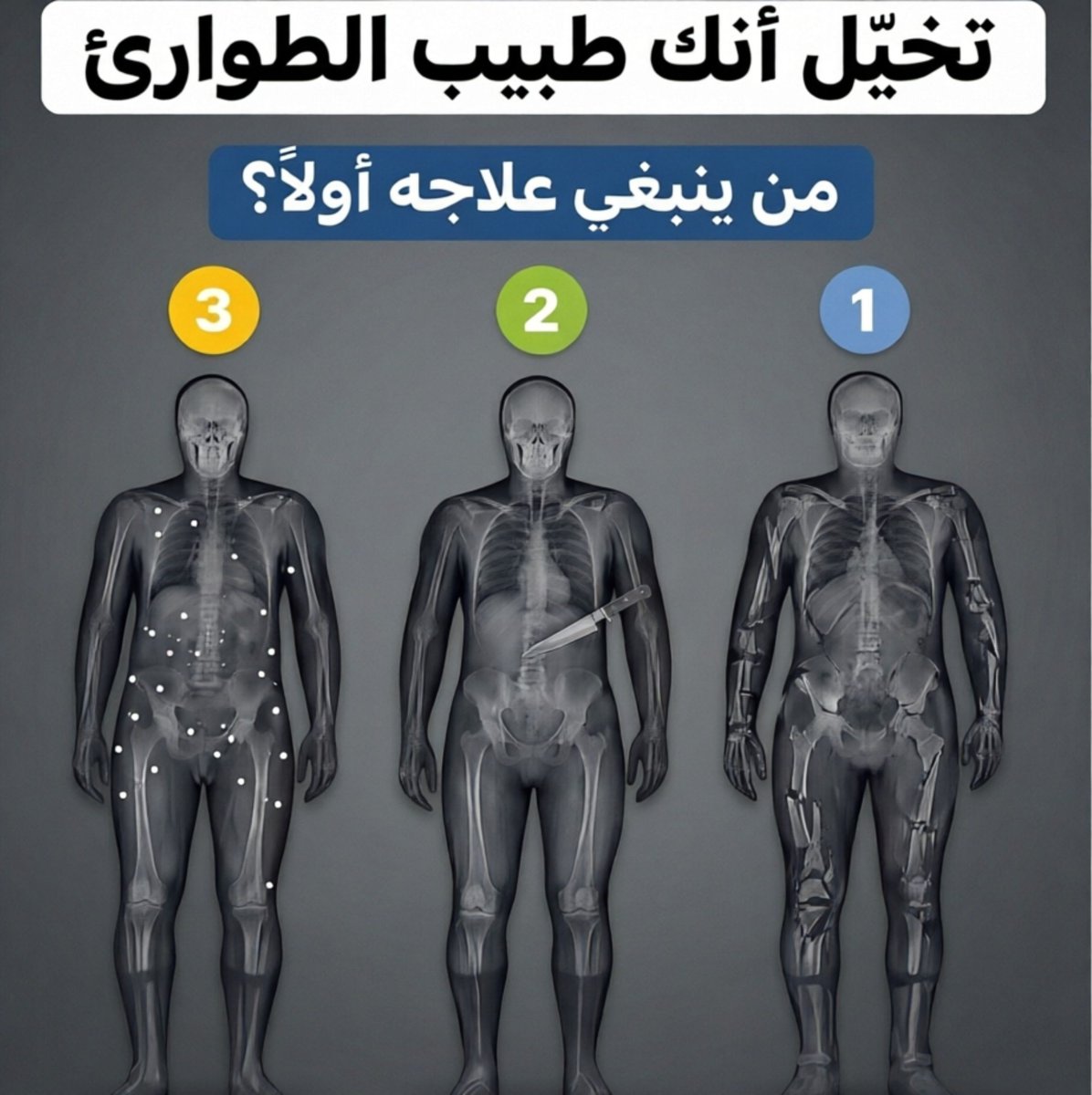 Alnumiri11's tweet photo. تخيّل أنك طبيب الطوارئ… ووصل أمامك هؤلاء الثلاثة في نفس اللحظة!

كل واحد منهم لديه إصابة مختلفة، لكن واحدًا منهم يحتاج تدخلك أولًا لإنقاذ حياته 

 المصاب 1: إصابات وكسور متعددة
 المصاب 2: جسم معدني نافذ في البطن
 المصاب 3: إصابات بطلقات نارية متعددة

❓ من منهم يحتاج التدخل أولًا؟!