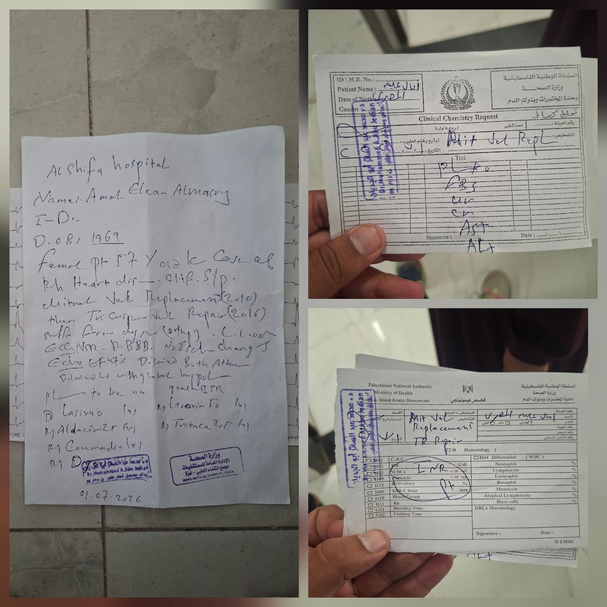 ahmedmasri2002's tweet photo. My mother needs $250 every week for her medical care.

This amount covers:

- Blood clotting tests (PT/INR)
- Blood chemistry tests
- The medication she depends on every day after surviving two open-heart surgeries.

At the same time, my family struggles to afford even our basic needs. We lost everything, and every day has become a struggle just to survive.

These are the basic medical costs my mother needs each week, while we are also trying to meet our family’s other essential needs.

Donate what you can; no amount is too small for a family struggling day after day to survive in Gaza. 🙏

https://t.co/kjevKsg0pc