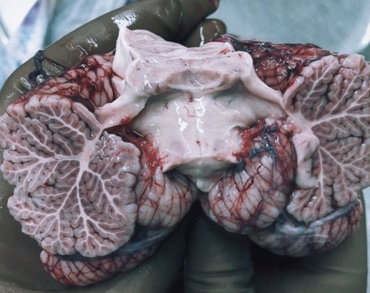 moriitician's tweet photo. the cerebellum.
( horror prop / sfx art ) https://t.co/b2gbLMv7ar