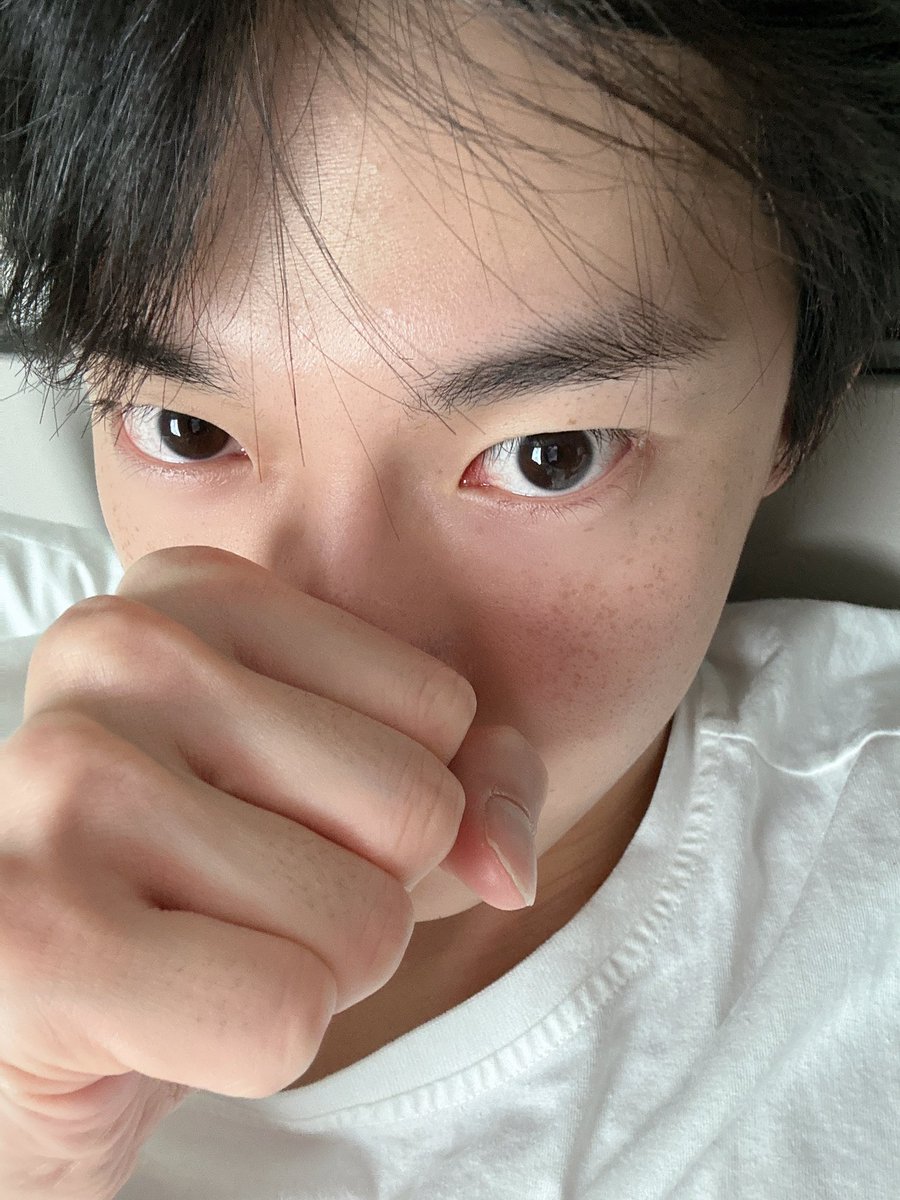 7do0_n's tweet photo. 주근깨 잘 보이는 셀카 좋다🫪 https://t.co/SDbTHIHoiT