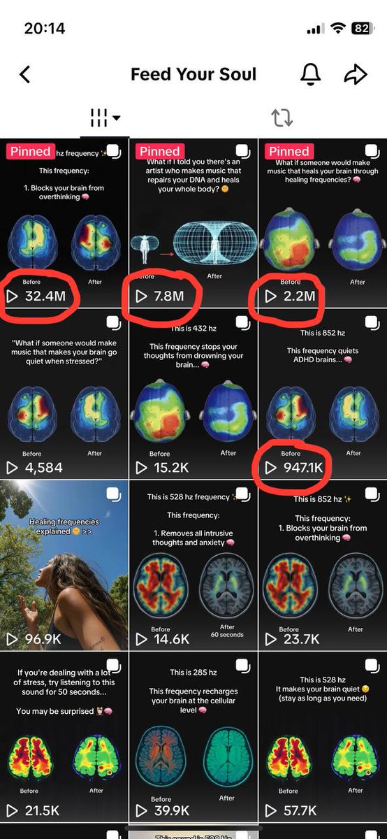 salezmass's tweet photo. 230M+ views monetising sounds

Sounds crazy but makes $30K+ monthly:

1. Setup a tiktok account making people listen to music at specific wavelength
2. Talk about how beneficial is it for health and how it can solve the pains of viewers (anxiety, stress, brain fog)
3. Funnel people into your tiktok "songs" which are really just sounds
4. Spotify pays $2.38 per 1000 streams
5. Make people addicted to these sounds and make them play it everytime they feel their pain
6. Get 12M streams per month and make $30K monthly