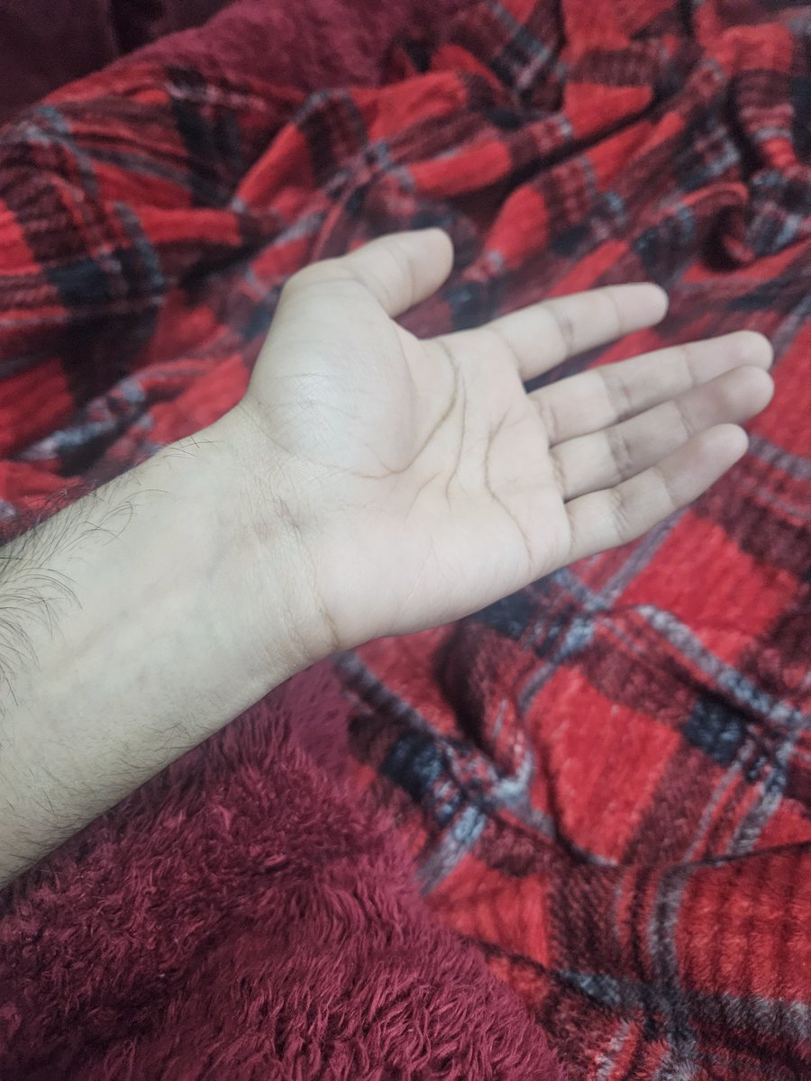 Marehya_Shah's tweet photo. Grok am I white @grok

Respond yes or no purely based on the picture. Thanks in advance https://t.co/296EeSAatW