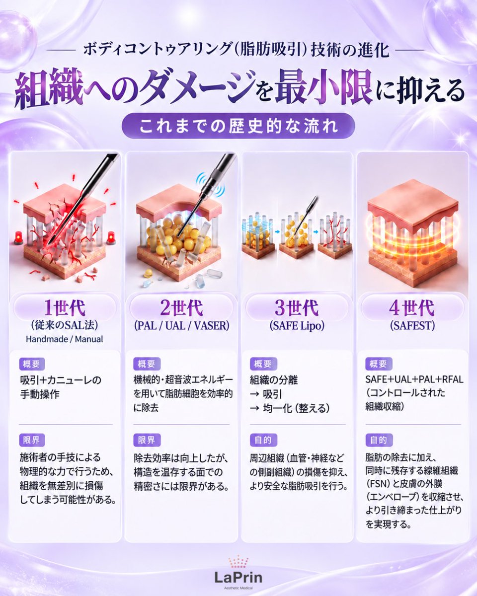 laprin_jpkr's tweet photo. ＼ 脂肪吸引も「第4世代」へ✨ ／

ただ脂肪を取り除くだけではなく、
組織へのダメージをできる限り抑えながら、美しい仕上がりを目指す。

脂肪吸引技術がどのように進化してきたのかを
分かりやすくまとめました💡

脂肪吸引を検討中の方は、ぜひ保存して参考にしてください🫶 https://t.co/J5Ak9bHMrj
