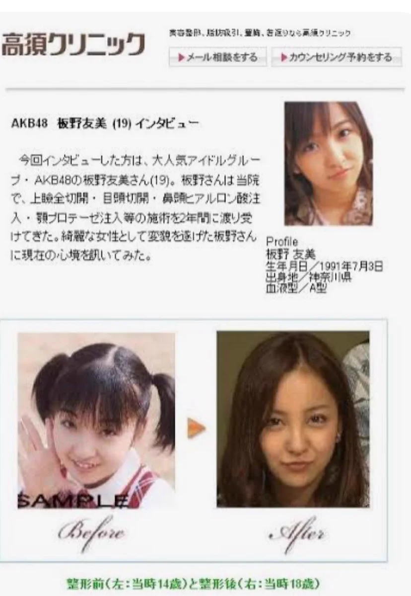 板野 友美 整形 前