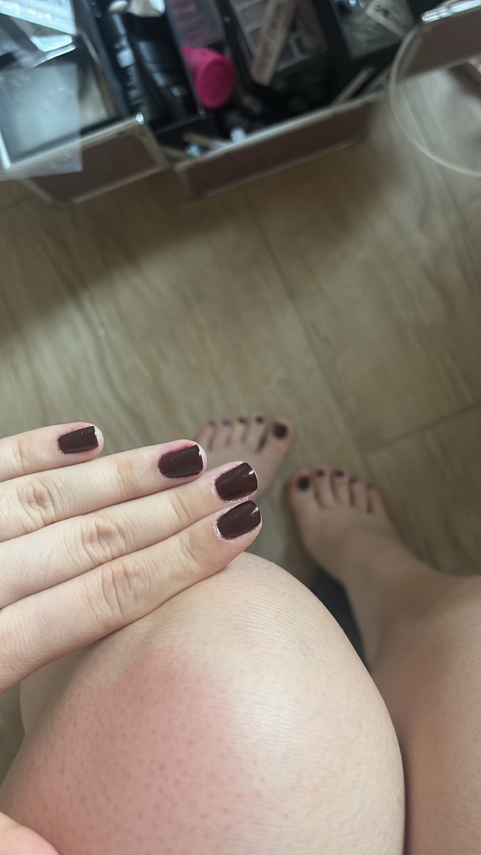 kittensDom's tweet photo. perfect hands n feet. Who wants to spoil them? 🐶👠#milan!!! #miss https://t.co/aIh3z4RmWZ