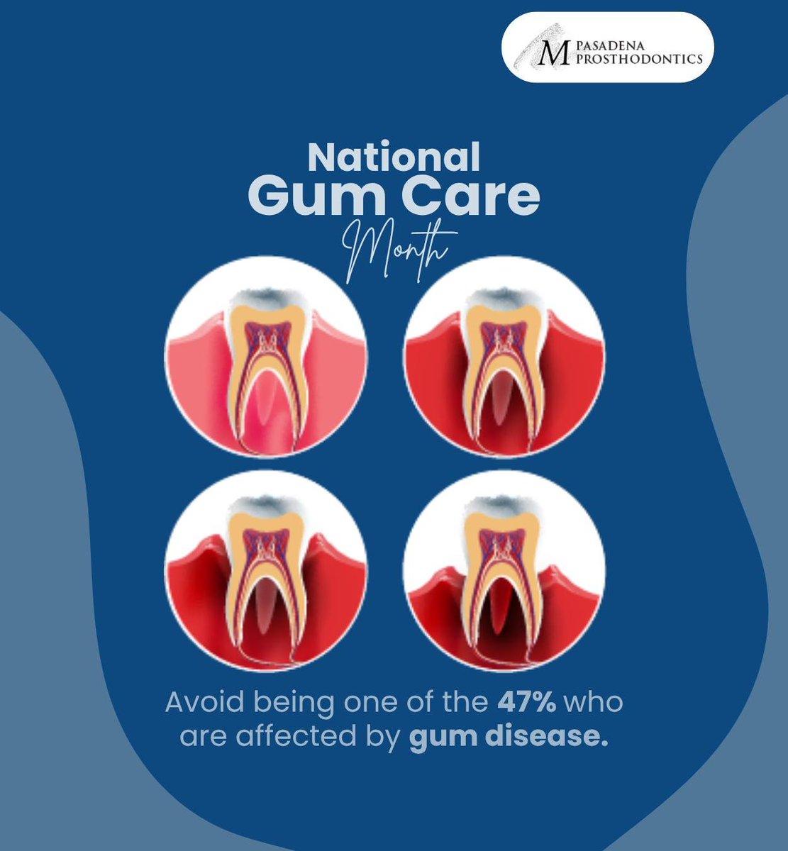 PasadenaProsth1's tweet photo. Around 47 percent of Americans suffer from gum disease. If left untreated, gum disease can lead to severe consequences that affect your oral health. Book an appointment today to protect your oral health. #gumdisease #gumcare #nationalgumcaremonth #pasadena #pasadenaprosthodontics https://t.co/lC9qxpGQBW