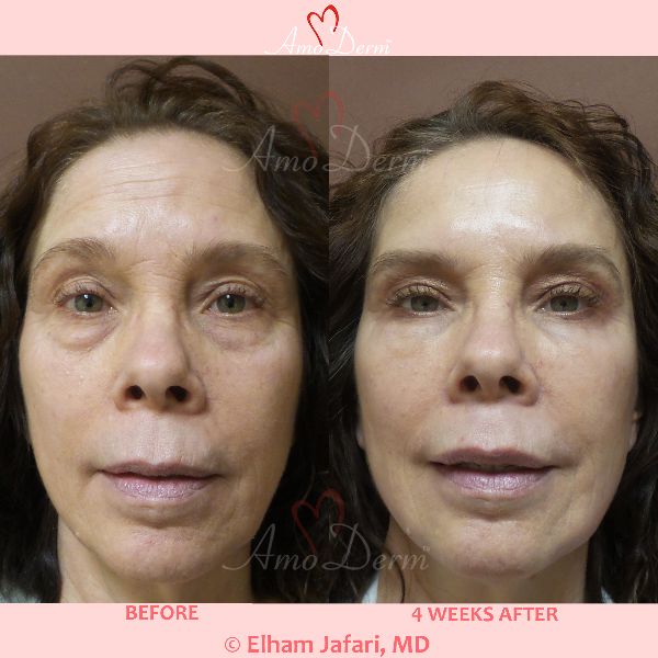 Amoderm's tweet photo. Prices Released: Amoderm Annual Beauty Day - https://t.co/8eVA1p3kGB https://t.co/X9raw3GZCy