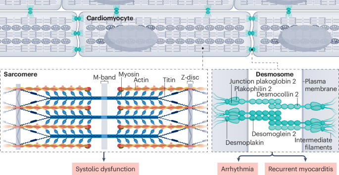 NatRevCardiol's tweet photo. New online!  Genetic cardiomyopathy-associated myocarditis https://t.co/ArvR76vidk https://t.co/fZNB2EVxqk