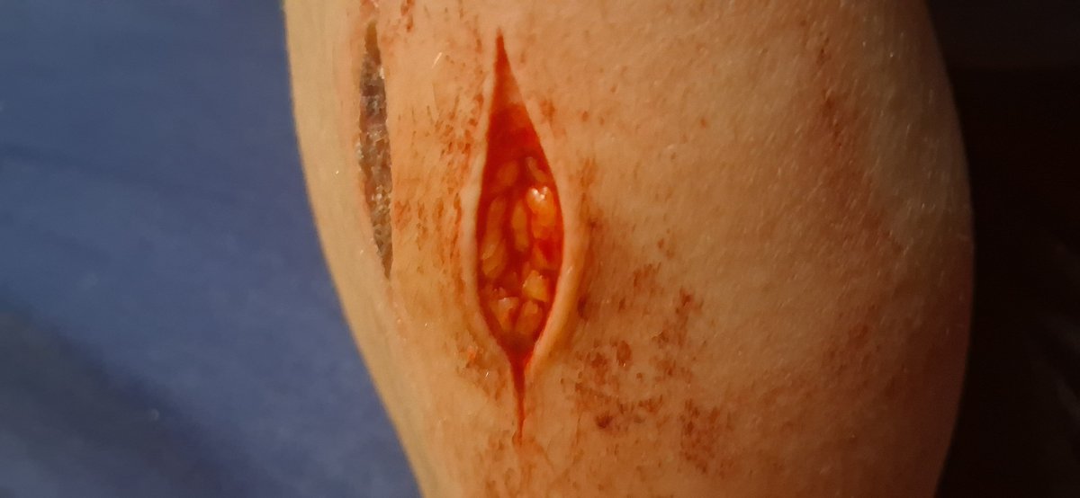 cv77ingb0ard's tweet photo. i wanna cover myself head to toe with super sexy scars 🎶
some SFX MAKEUP i painted earlier, ALL FAKE
#beans #988twt #shtwt https://t.co/ykP8lwmBsi