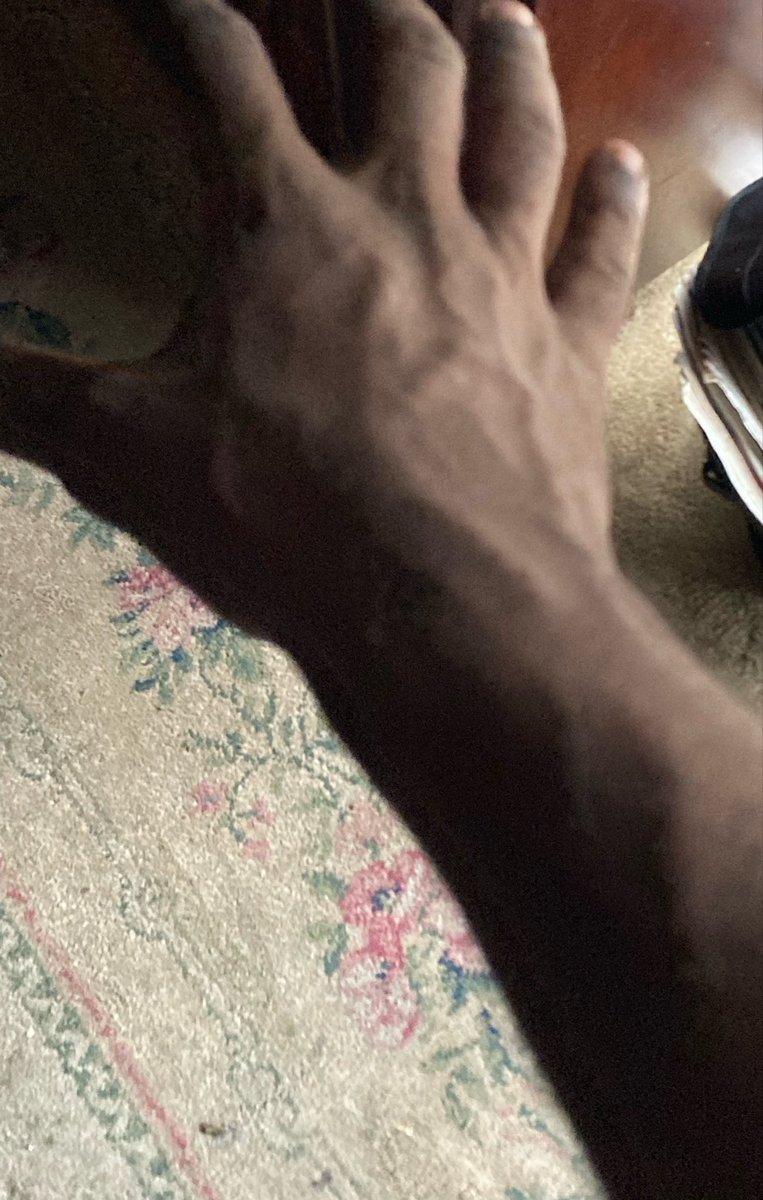 FrostyLicks777's tweet photo. Veins after lifting today https://t.co/K7Qd4N3pvt